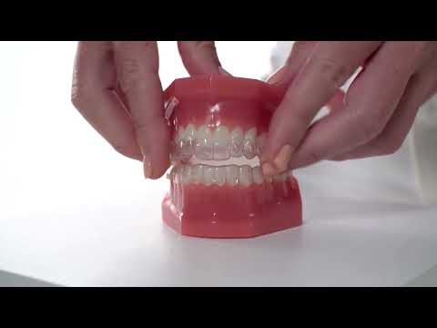 OrVance® Whitening Treatment